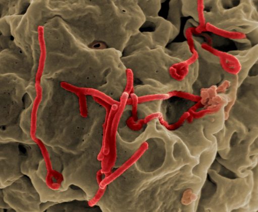 Caz suspect de Ebola în Cehia. Autoritățile au lansat un răspuns de urgență pe scară largă