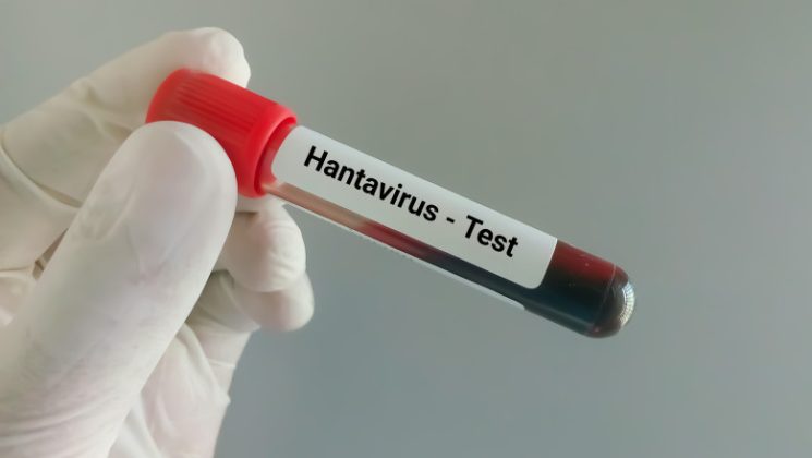Hantavirus în România. Medicii vin cu o veste bună: Persoana infectată din Arad nu a contractat recent virusul ci era cronic